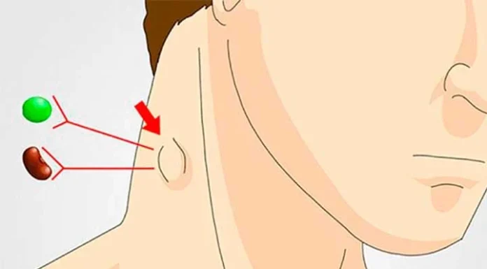 6 remedii naturiste pentru detoxifierea sistemului limfatic.