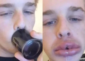 Cele mai stupide 12 mode care ne-au însoțit de-a lungul istoriei
