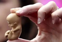 ▷Țări în care avortul este legal