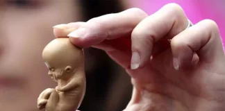 ▷Țări în care avortul este legal