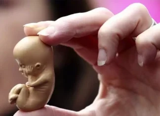 ▷Țări în care avortul este legal